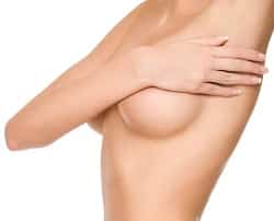 breast augmentation stock 1