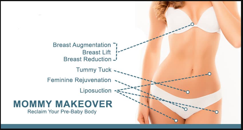 a diagram showing what areas on a woman's torso are worked on in a mommy makeover