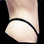 After Liposuction Dallas TX