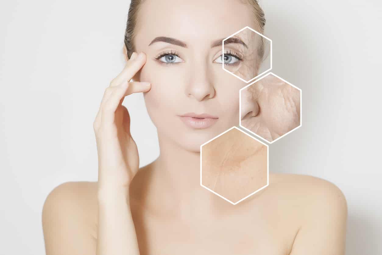 Virtue RF Microneedling Dallas TX