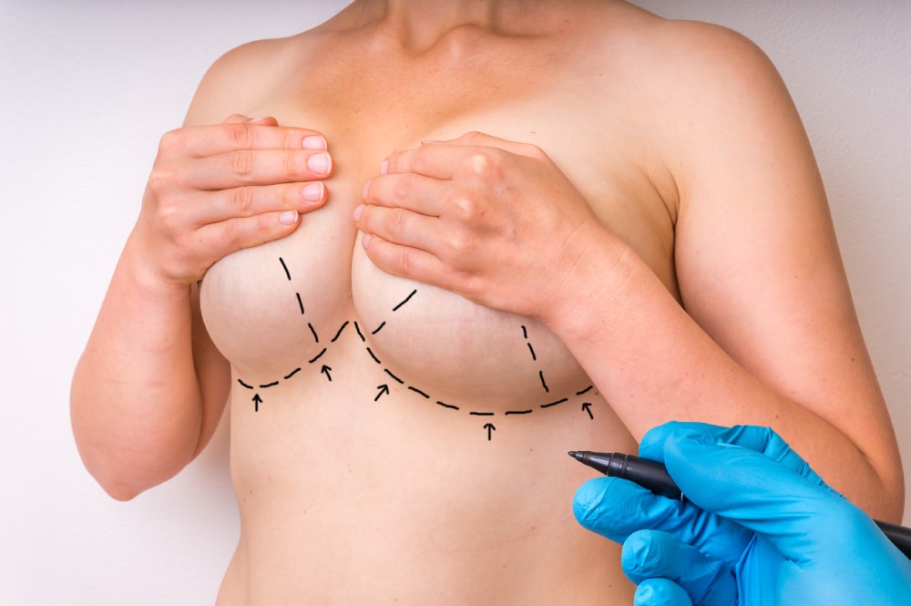 Breast Correction Dallas TX