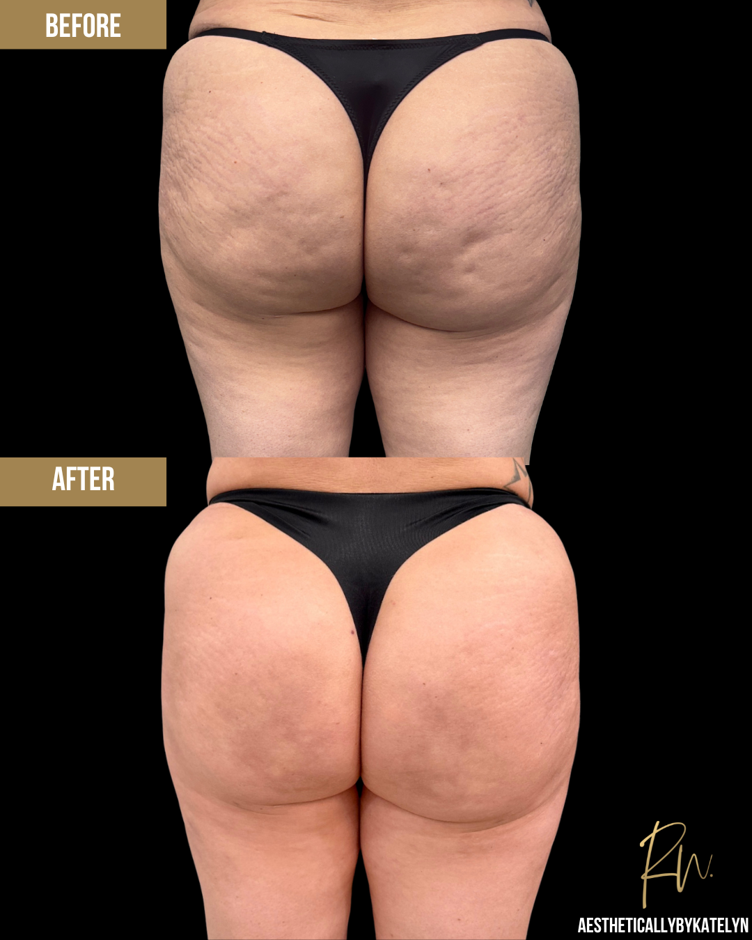 Aveli Before and After