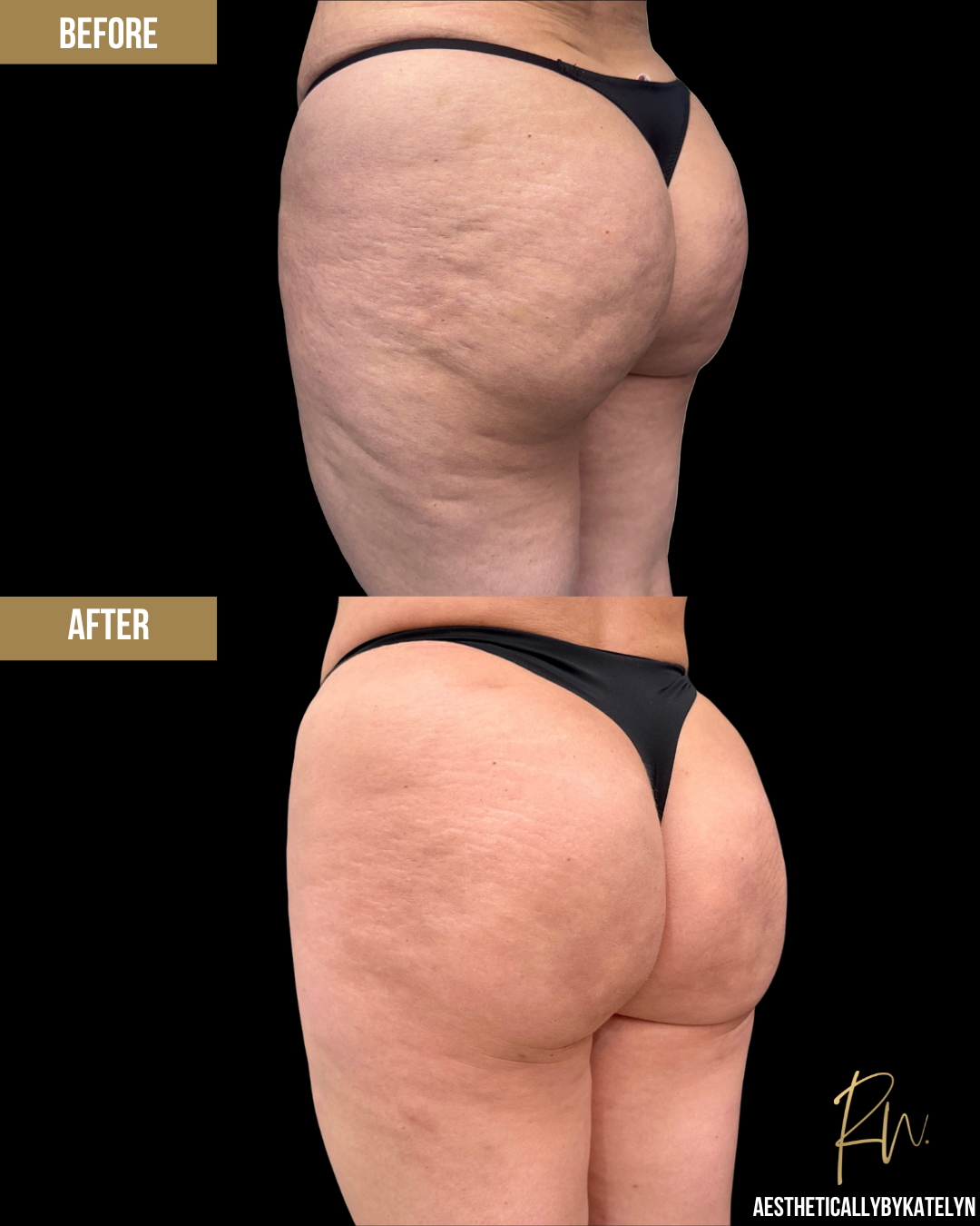 Aveli Before and After