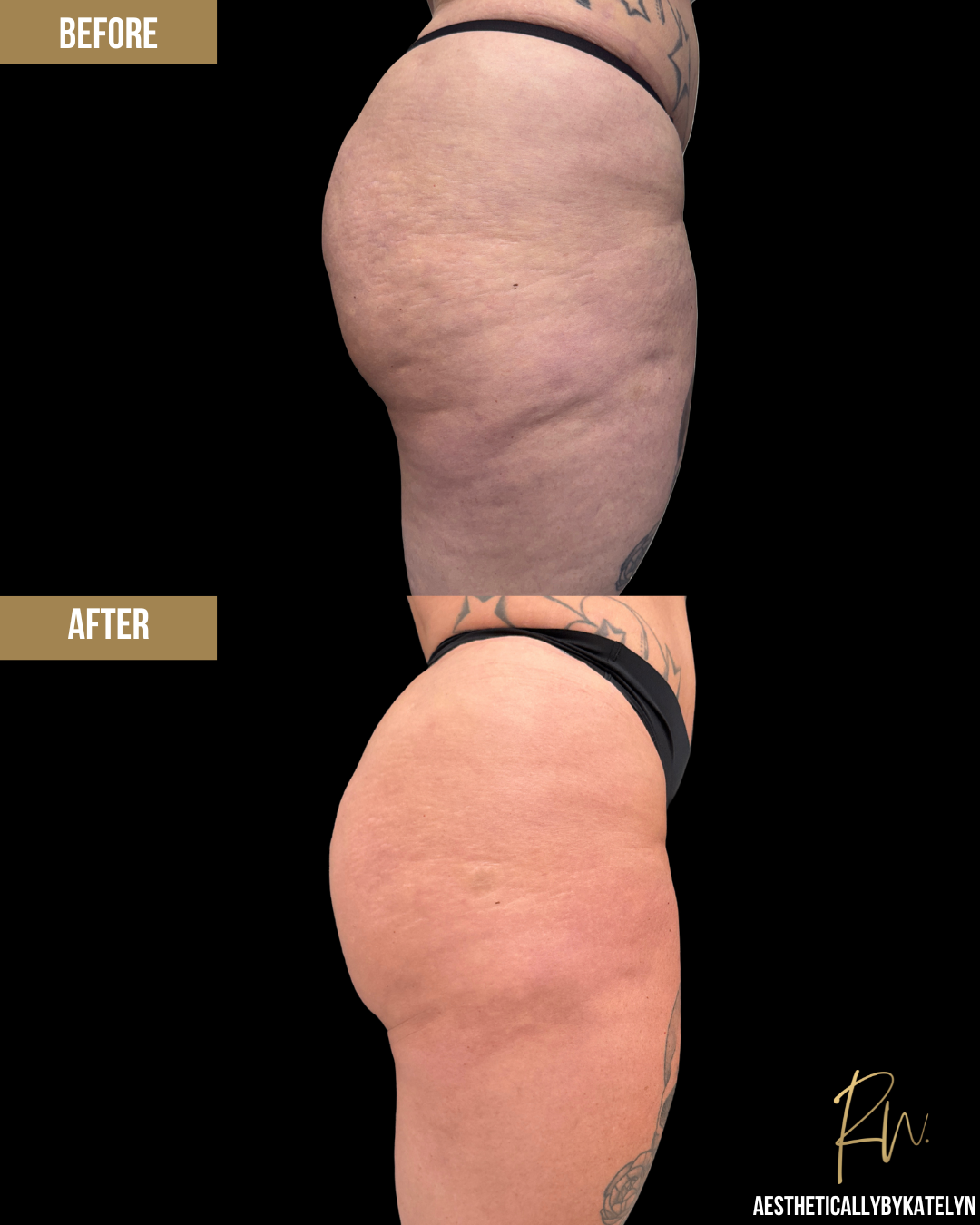 Aveli Before and After