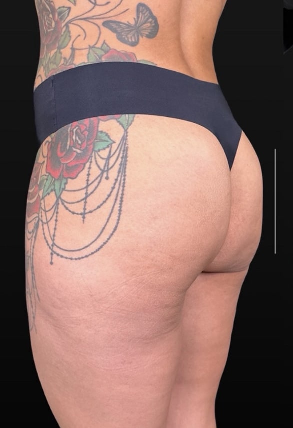 Before Image: Case #10376 – Alloclae - left-back-oblique