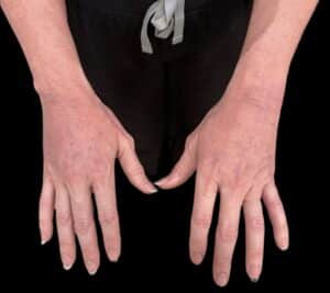 After Image: Case #10377 – Alloclae