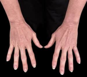 Before Image: Case #10377 – Alloclae