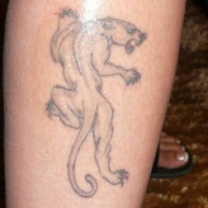 Before Image: Case #2676 – Laser Tattoo Removal - other