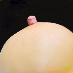 Before Image: Case #2449 – Nipple Reduction - front