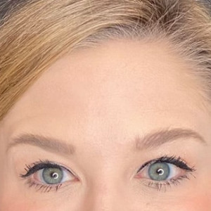 After Image: Case #6273 – Botox - other