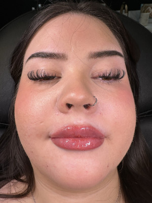 After Image: Lips by Katelyn Gross, BSN RN - front