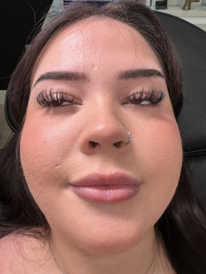 Before Image: Lips by Katelyn Gross, BSN RN - front