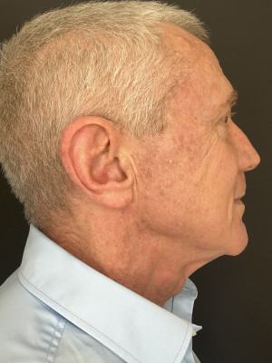 After Image: Case #7950 – Maintenance Laser - other