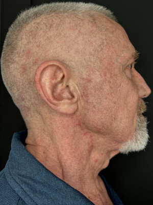 Before Image: Case #7950 – Maintenance Laser - other